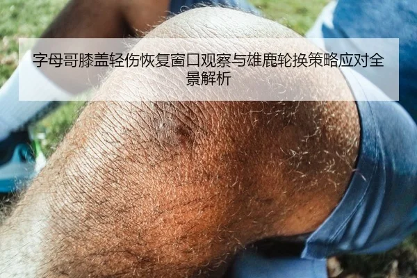 字母哥膝盖轻伤恢复窗口观察与雄鹿轮换策略应对全景解析